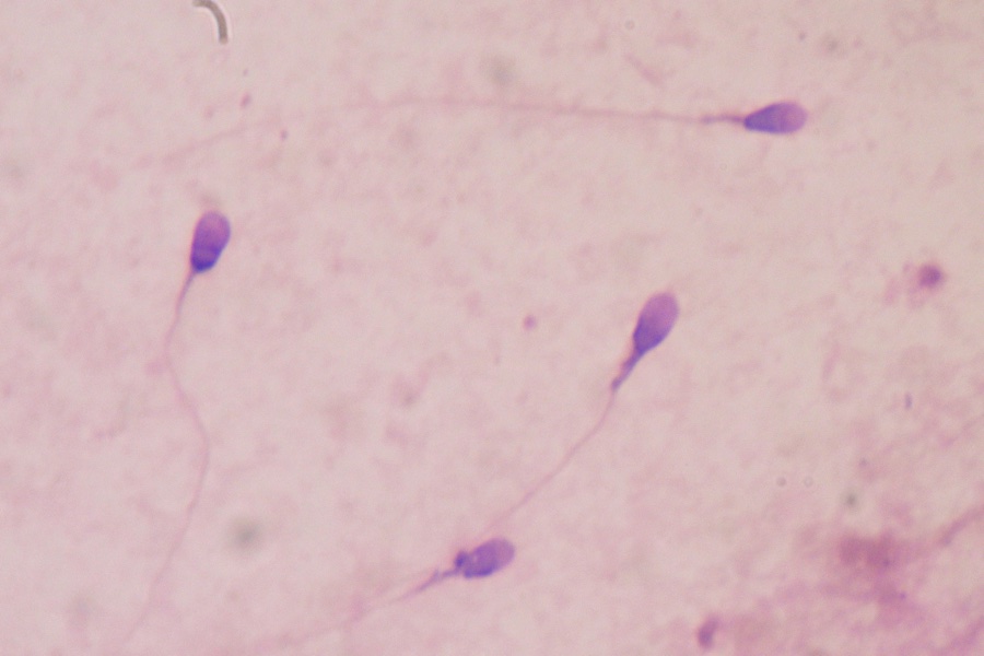 sperm cell under microscope labeled
